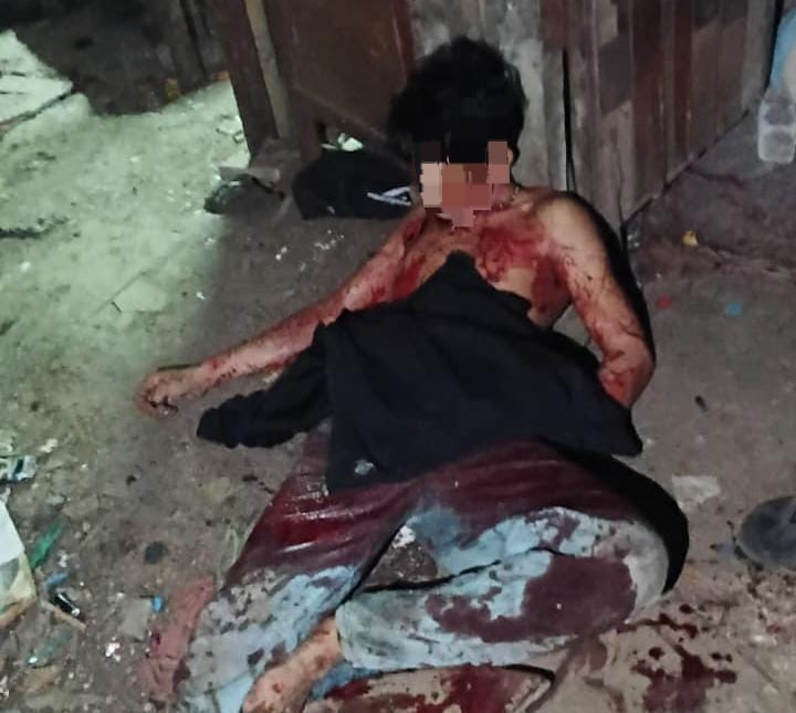 Diduga Dipicu Salah Paham Saat Pesta Miras, Seorang Pemulung Tewas Ditikam Rekannya di Manggala